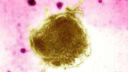 Estimates say that 3 in 1,000 children who get measles will die of respiratory and neurologic complications.