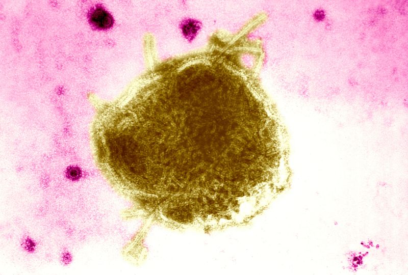 First Measles Death in a Decade A Wake-Up Call for the US