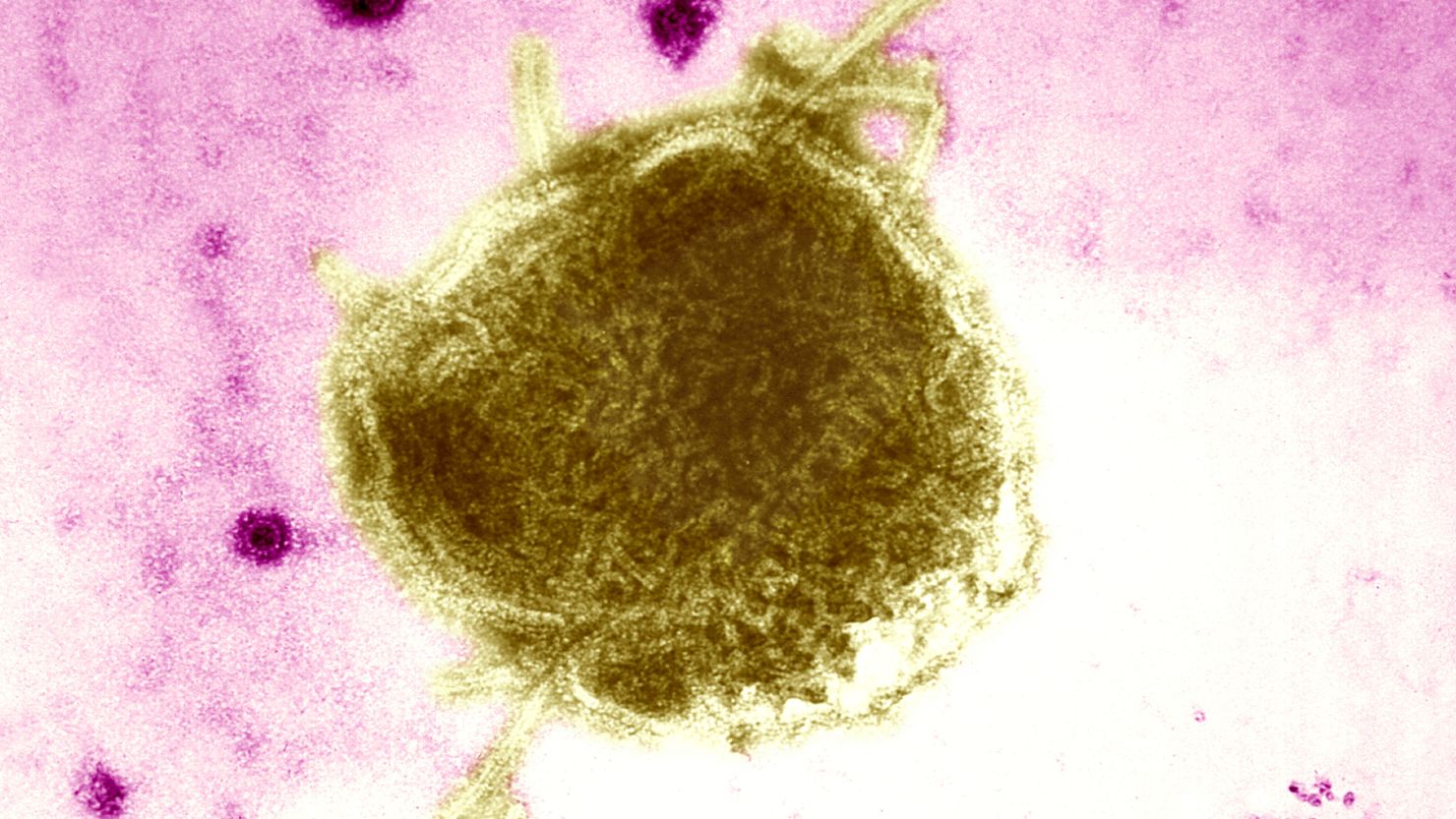A measles outbreak in West Texas has expanded to 48 cases.