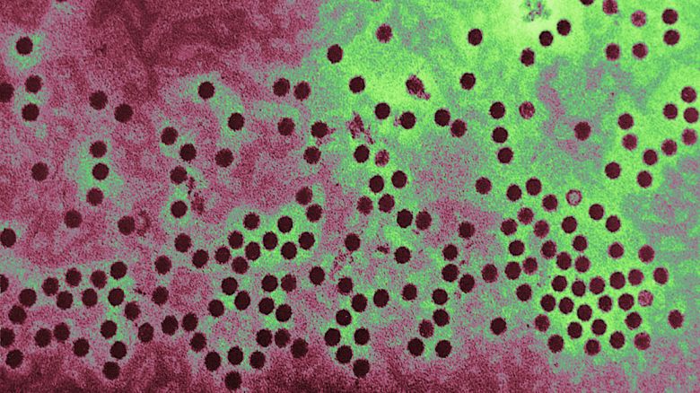 This Electron Micrograph Depicts A Number Of Parvovirus H 1 Virions Of The Parvoviridae Family Of Dna Viruses. The Parvoviridae Family Of Viruses Also Contains The Parvovirus B19 Virion, Which Is Responsible For Causing Erythema Infectiosum, Or "Fifth Disease". (Photo By BSIP/UIG Via Getty Images)