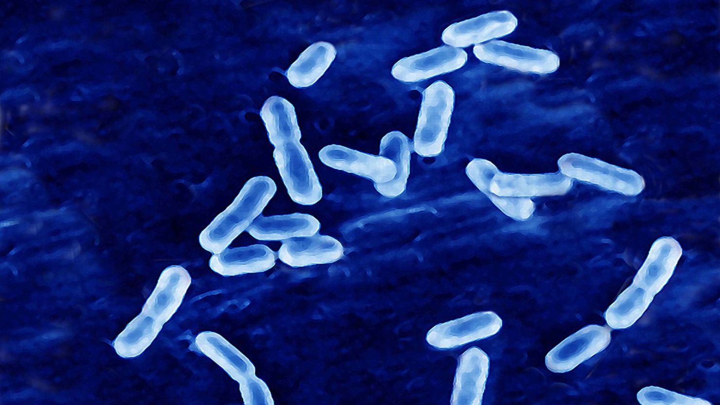 Dont Eat This One Death Prompts Major Recall Of Listeria Contaminated Food - xg5yb04