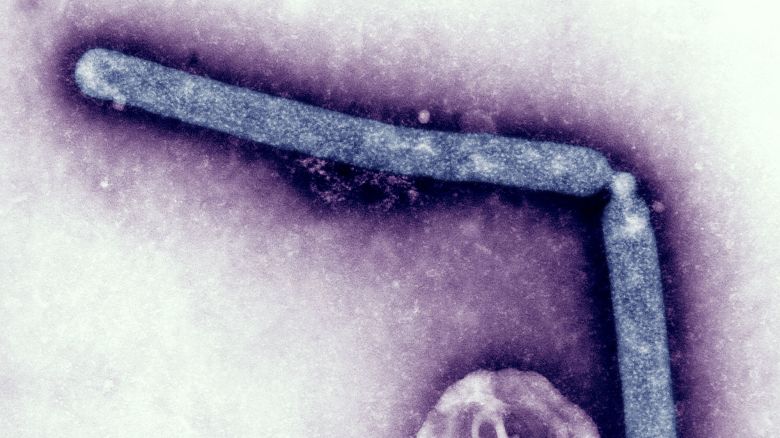 This Transmission Electron Micrograph Tem, Taken At A Magnification Of 108,000X, Revealed The Ultrastructural Details Of Two Avian Influenza A H5N1 Virions, A Type Of Bird Flu Virus, Which Is A Subtype Of Avian Influenza A. At This Magnification, One May Note The Stippled Appearance Of The Roughened Surface Of The Proteinaceous Coat Encasing Each Virion. Although This Virus Does Not Typically Infect Humans, In 1997, The First Instance Of Direct Bird To Human Spread Of Influenza A H5N1 Virus Was Documented During An Outbreak Of Avian Influenza Among Poultry In Hong Kong. The Virus Caused Severe Respiratory Illness In 18 People, Of Whom, 6 Had Died. Since That Time, There Have Been Other Instances Of H5N1 Infection Among Humans. During August To October, 2004, Sporadic Human Cases Of Avian Influenza A H5N1 Were Reported In Vietnam And Thailand. Since December, 2004, A Resurgence Of Poultry Outbreaks And Human Cases Has Been Reported In Vietnam. On February 2, 2005, The First Of Four Human Cases Of H5N1 Infection From Cambodia Was Reported. On July 21, 2005, The First Human Case Of H5N1 In Indonesia Was Reported, And Since Then Indonesia Has Continued To Report Human Cases In August, September, And October, 2005. (Photo By BSIP/UIG Via Getty Images)
