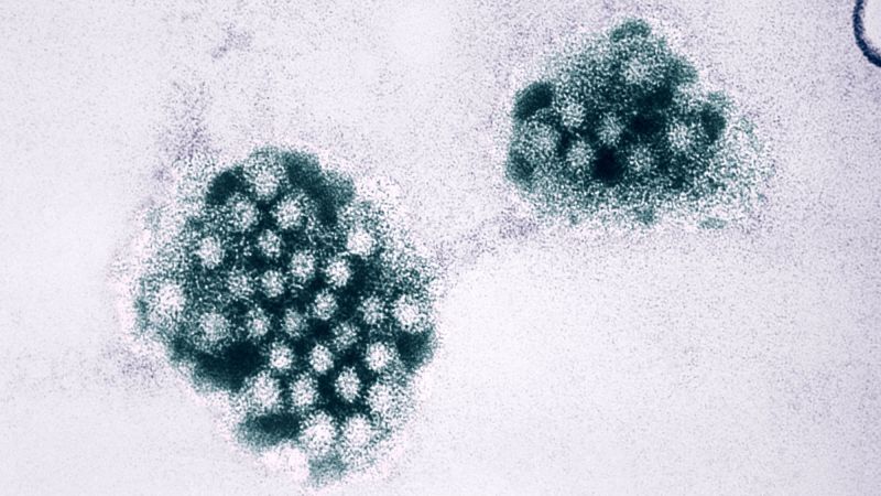 Norovirus Outbreak Prevention