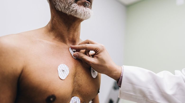 Close-up of human hands putting sensors of electrocardiography on a doctor's office