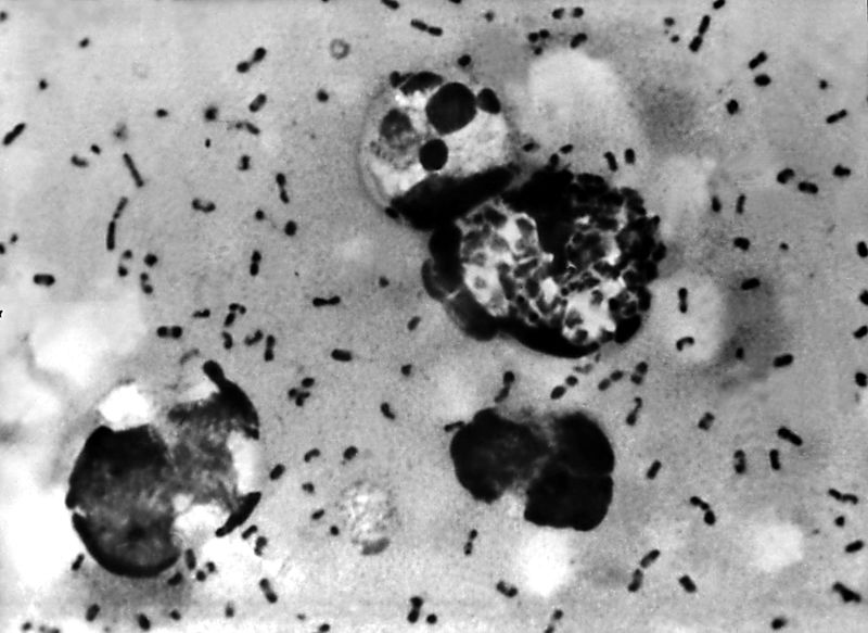 Russian lab worker dies after suspected plague exposure; pneumonic plague, the 'Black Death' that killed 50M in Europe, resurfaces