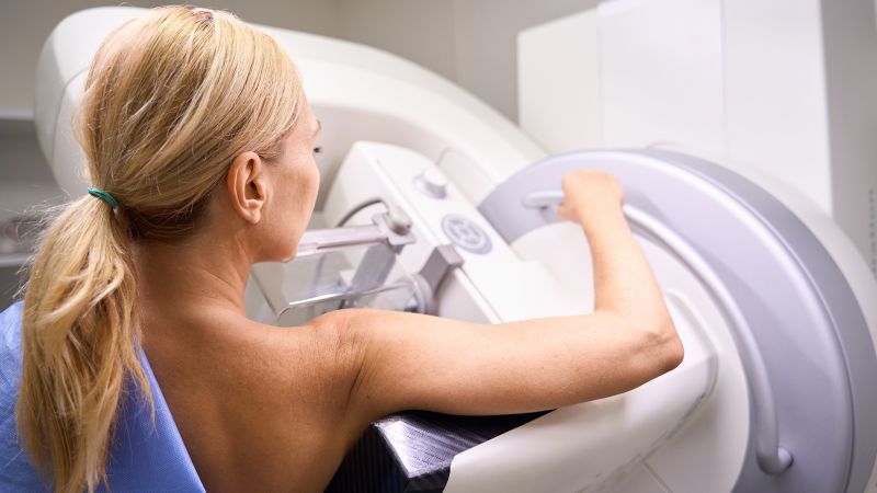 Tagad ir ieteicams veikt mammogrammu, sākot no 40 gadu vecuma.  Vai jums vajadzētu tādu iegūt?