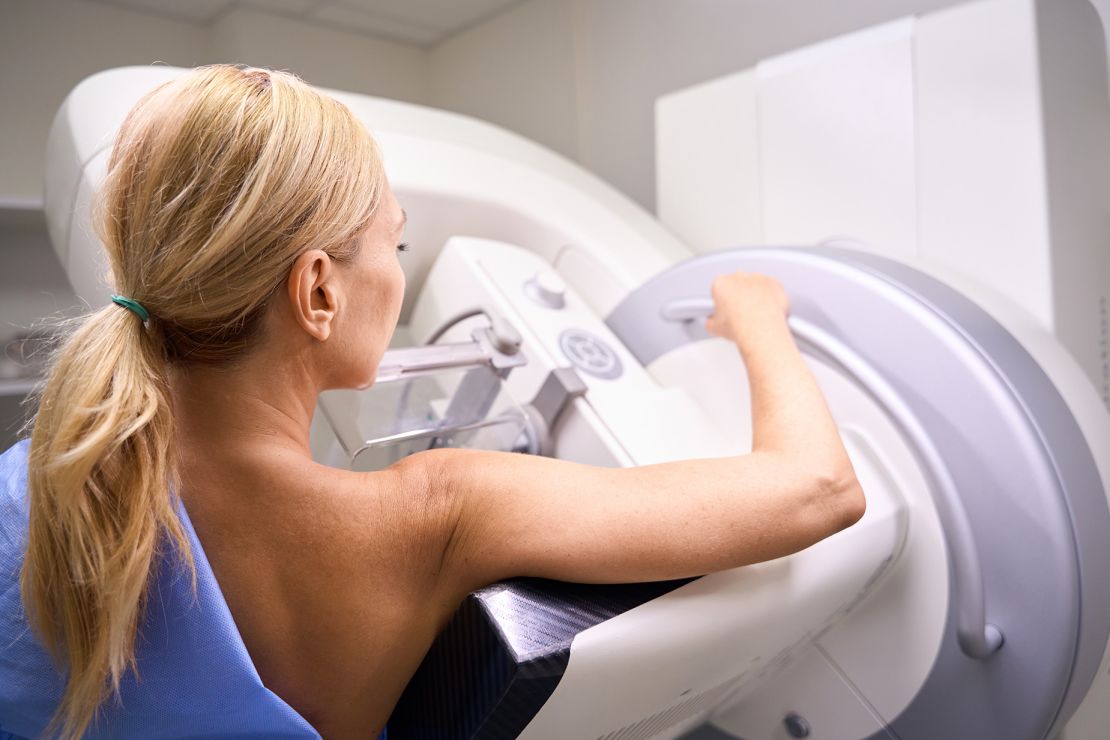 Skats no aizmugures ar sievieti, kurai tiek veikta digitālā krūšu tomosintēze, izmantojot modernu diagnostikas aprīkojumu
