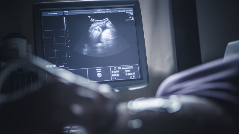 Ob/gyn group recommends Covid-19 vaccines during pregnancy, another major group to break from CDC