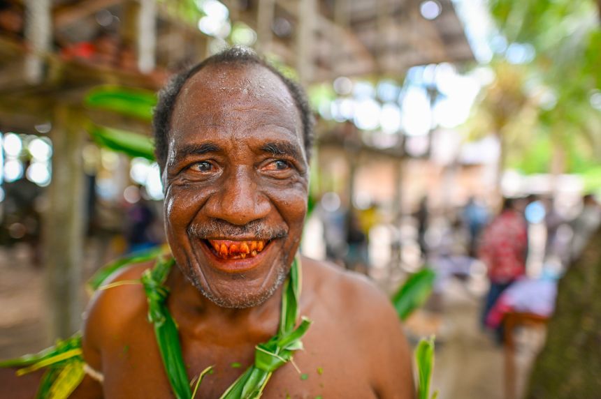 Chewing betel quids can cause reddish-brown staining on the teeth, like in this man pictured in the Solomon Islands.