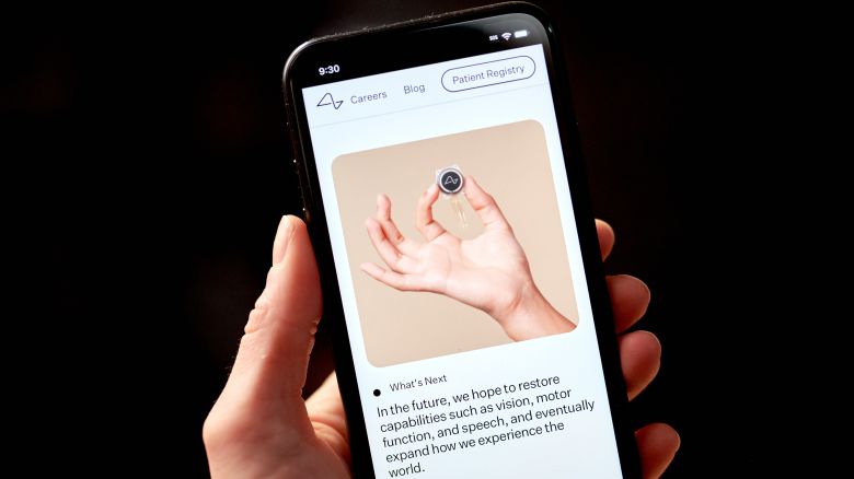 The Neuralink website on a smartphone arranged in New York, US, on Wednesday, Jan. 31, 2024. Elon Musk said that the first human patient has received a brain implant from his startup Neuralink Corp., a significant step forward for the company that aims to one day let humans control computers with their minds.