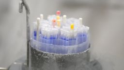 This photograph shows vials containing sperm frozen in liquid nitrogen being prepared at the Study and Conservation of Human Eggs and Sperm (Centres d'etude et de conservation des ufs et du sperme humains - CECOS) at the university hospital (CHU) of Rennes, western , on March 12, 2024. On March 13, 2024, 1.100 vials containing frozen sperm stored in vats of liquid nitrogen were transported from Renne's University hospital (CHU) bound for Lille's University hospital, with two more shipments of 3.000 and 8.000 respectively to follow. The CECOS is experiencing a boom since the August 2, 2021 bioethic bill authorizing single women or women in same-sex couples to undertake Assisted Human Repoduction, driving demand for sperm donations. (Photo by Damien MEYER / AFP) (Photo by DAMIEN MEYER/AFP via Getty Images)