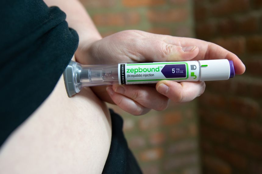 Zepbound has been approved since November 2023 for chronic weight management in adults with obesity or who are overweight.