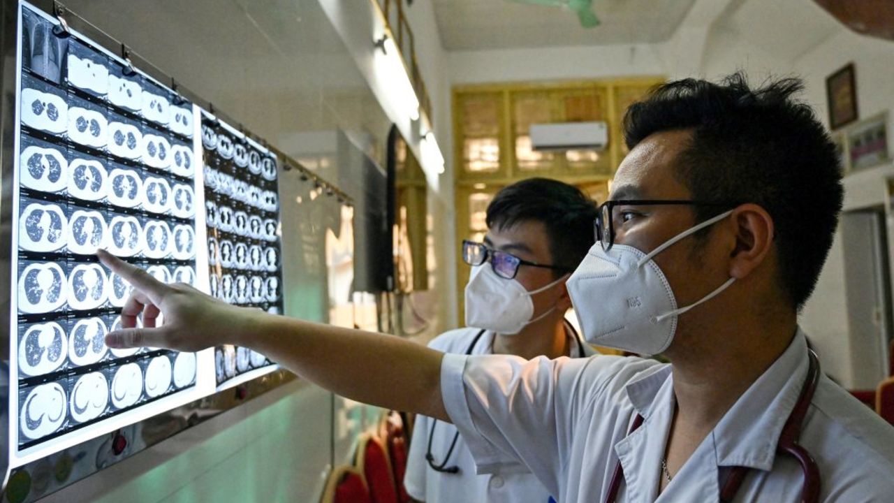 This picture taken on April 2, 2024 shows Vietnamese doctor Truong Duc Thai and his colleague checking X-ray film of a drug-resistant tuberculosis patient at National Lung Hospital in Hanoi. A faster and vastly more effective treatment for drug-resistant tuberculosis is being rolled out in the Asia-Pacific region, raising hopes of a "new era" in tackling one of the world's deadliest infectious diseases. (Photo by Nhac NGUYEN / AFP) / TO GO WITH "ASIA-HEALTH-TUBERCULOSIS" REPORTAGE BY PAM CASTRO (Photo by NHAC NGUYEN/AFP via Getty Images)