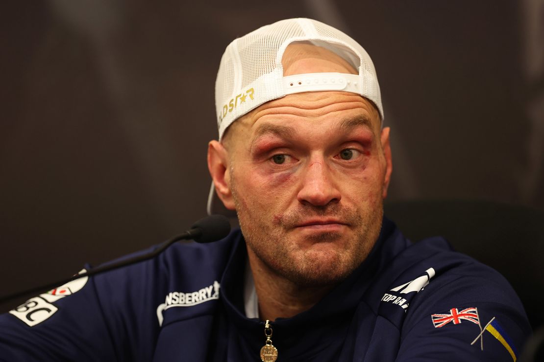 Tyson Fury suffered his first ever loss in professional boxing.