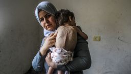 Amjad Al-Qanou, pictured in Gaza City, in northern Gaza, on June 9. The 3-year-old toddler is suffering from malnutrition, as human rights agencies warn of a deepening hunger crisis amid Israel's siege.