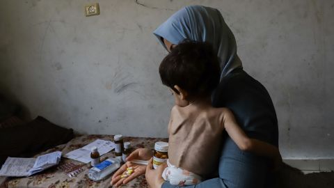 The mother of Amjed Al-Qanooa, 3, who suffers from severe malnutrition, shows the pills prescribed for her son in the Jabalia camp in northern Gaza on June 9, 2024.