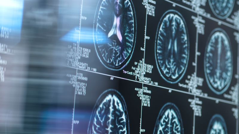 Lithium may help protect aginc brains from Alzheimer’s disease, new animal research shows