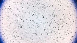 Normozoospermia normal sperm count and morphology. Microscopic image.