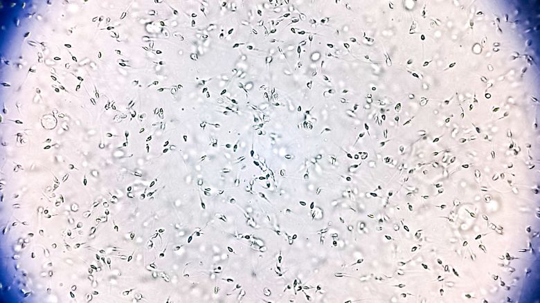 Normozoospermia normal sperm count and morphology. Microscopic image.