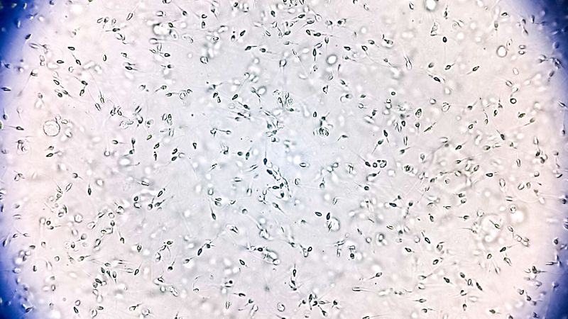 Sperm donor with rare genetic mutation fathered 67 children. Ten now have cancer, prompting calls for reform | CNN