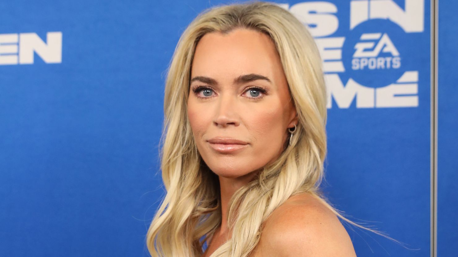 Teddi Mellencamp says her melanoma is now stage 4 | CNN