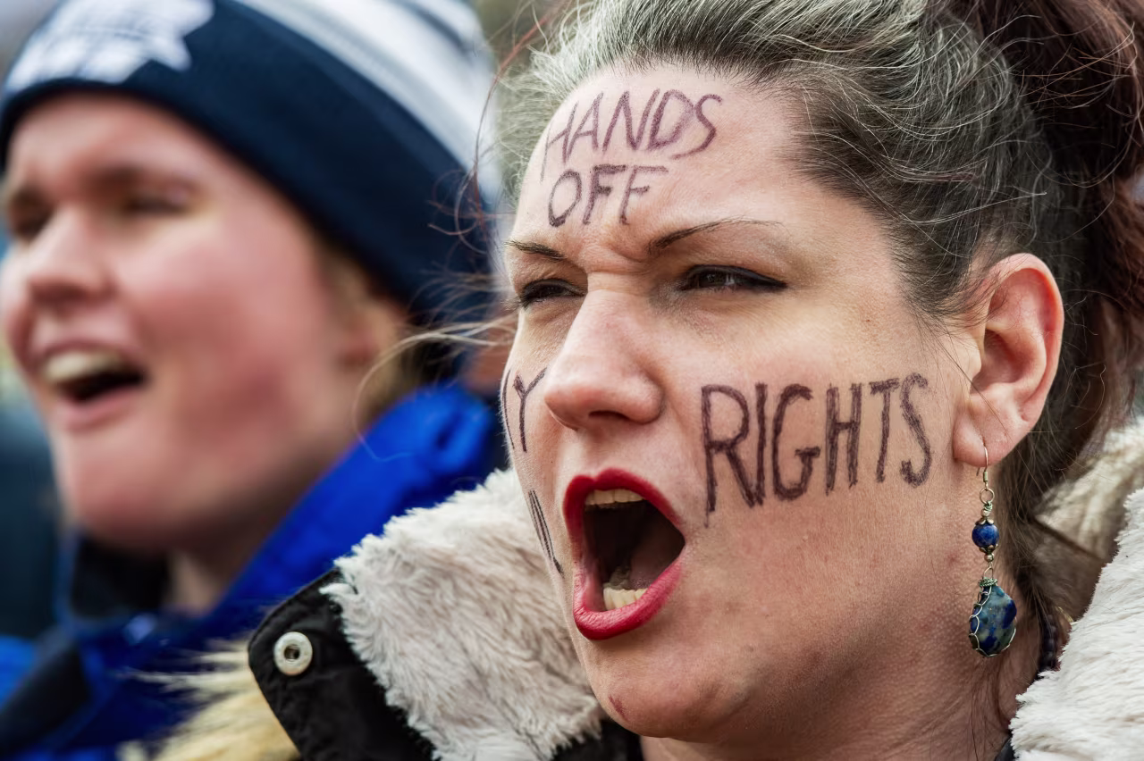 A woman with a message reading "hands off my rights" participates in a protest against US President Donald Trump and his policies near the Massachusetts Statehouse on Presidents' Day on Monday,, in Boston, Massachusetts.