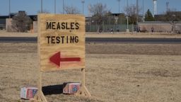 The West Texas measles outbreak continues to grow, with 159 confirmed cases as of Tuesday.