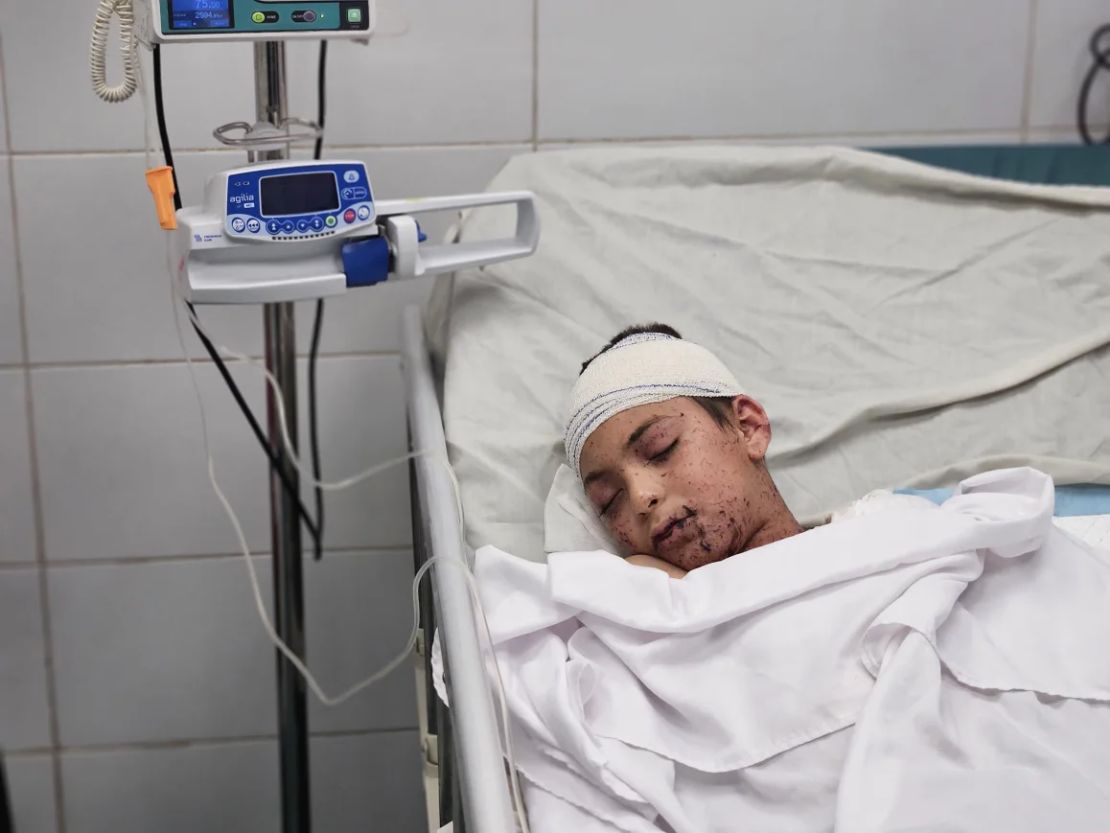 El único hijo con vida de la médica Alaa al-Najjar yace en una cama del hospital Nasser de Khan Younis después de que un ataque aéreo israelí impactara en su casa.