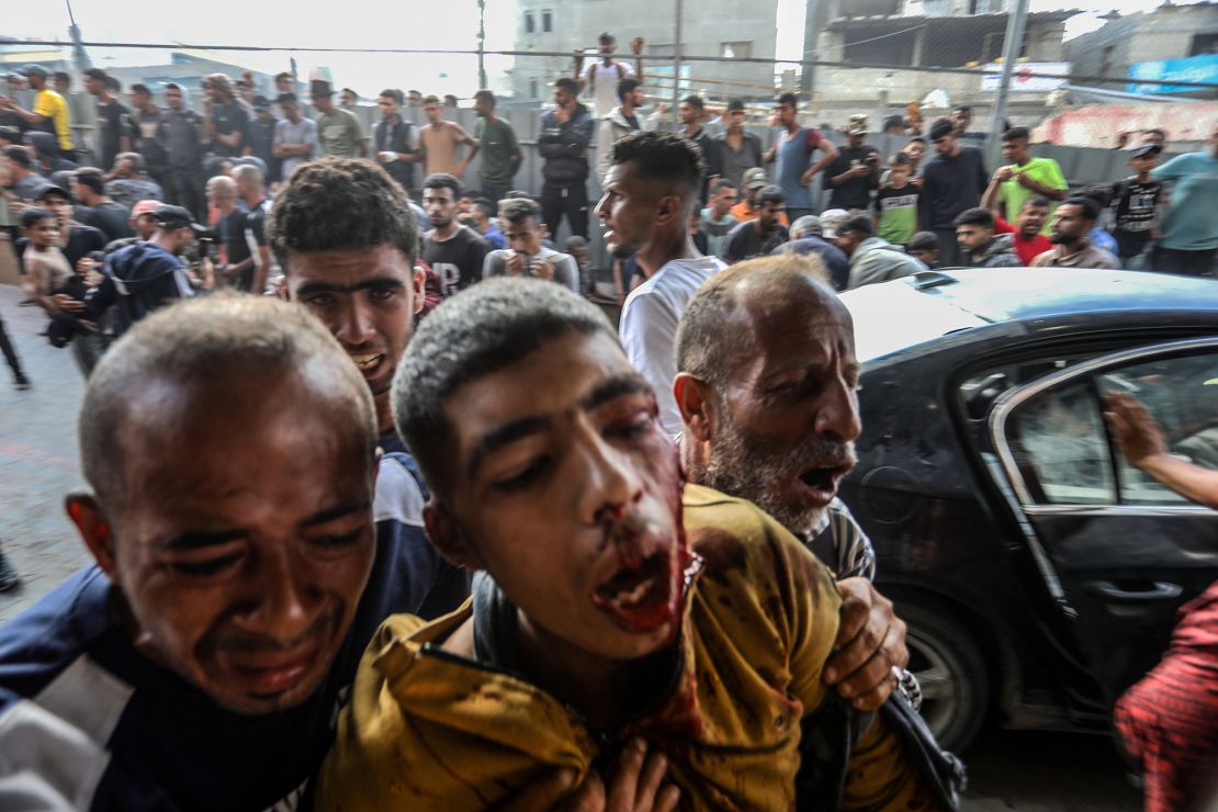 Wounded Palestinians are brought to Nasser Medical Complex, in southern Gaza, on June 17, 2025.