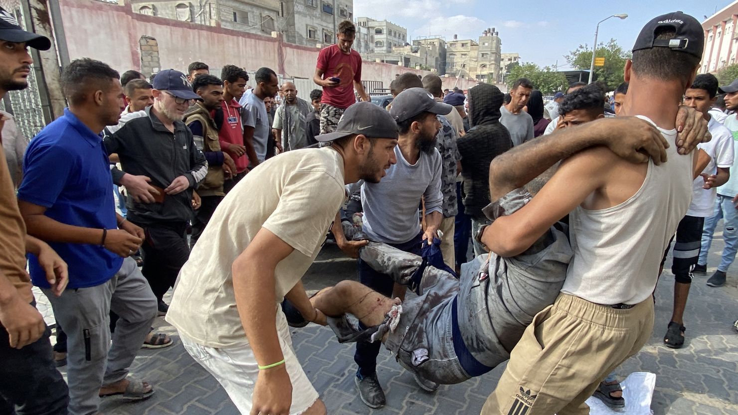 Palestinians transport an injured man to Nasser Medical Complex in southern Gaza after the Palestinian Ministry of Health said that over 50 people had been killed while seeking aid in Khan Younis on Tuesday.
