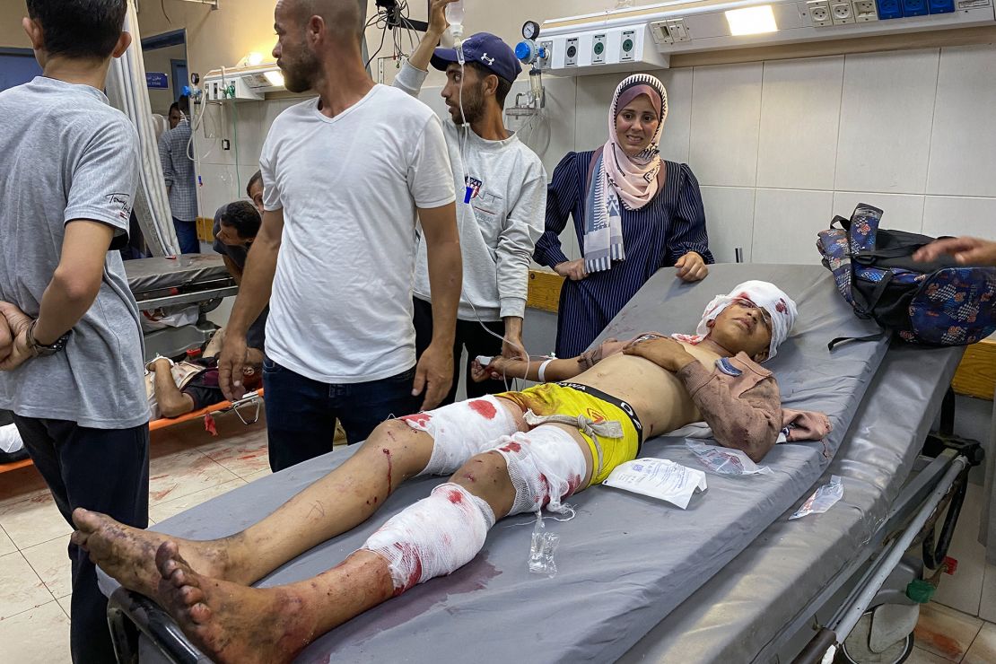 A young Palestinian, who was injured while seeking aid, is treated at the Nasser hospital in Khan Younis in southern Gaza on Tuesday.
