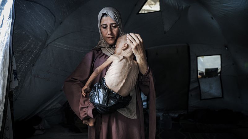 In Pictures: Starvation in Gaza In Pictures: Starvation in Gaza