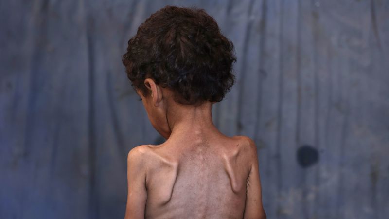 Aid worker in Gaza says she no longer recognizes friends due to hunger