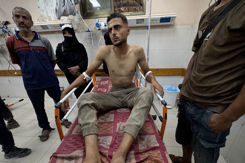 Abu Armanah is seen at Nasser Hospital in Khan Yunis on Friday.