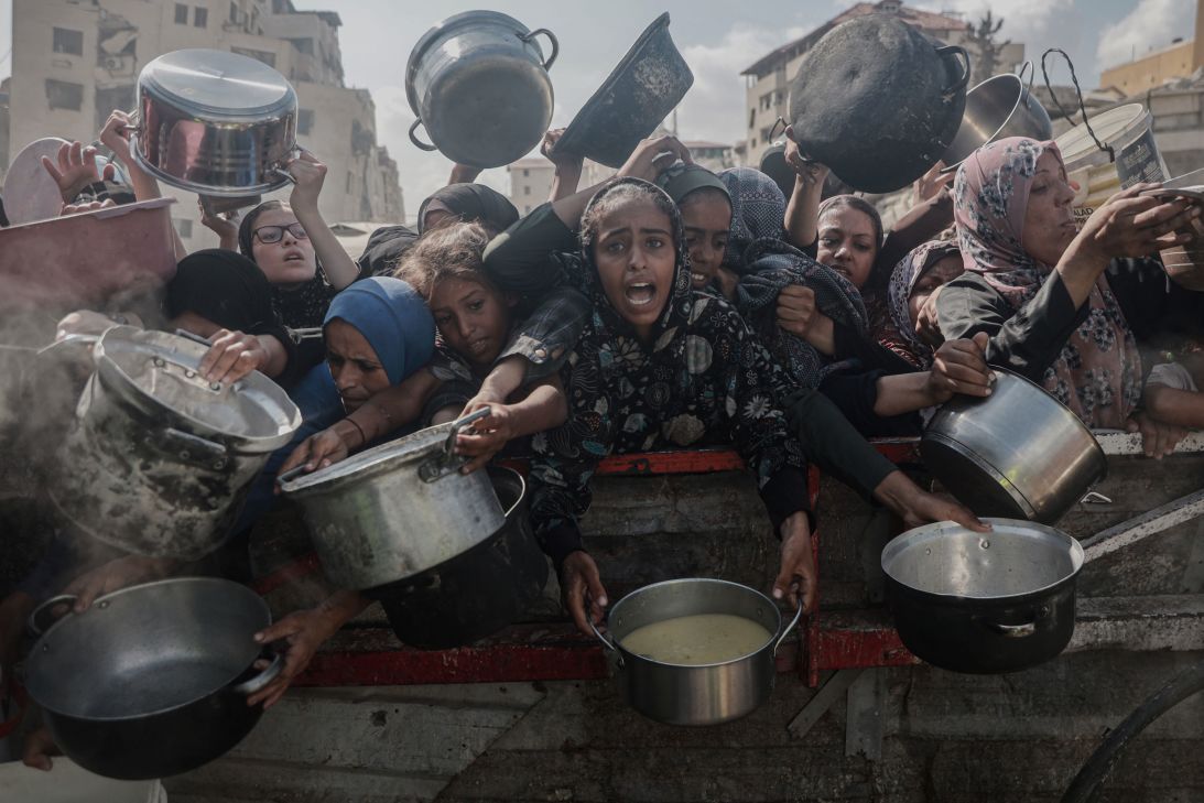 Nearly 12,000 children in Gaza were acutely malnourished in July, the highest monthly figure ever recorded, according to the UN Office for the Coordination of Humanitarian Affairs (OCHA).