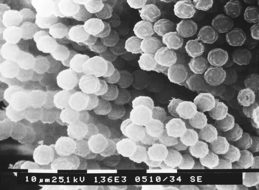 Chains of Aspergillus spores. Aspergillus is a fungus that is very common in the environment, found in soil, on plants and in decaying plant matter.