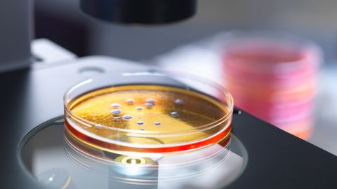 Petri dish containing bacterial culture being examined with inverted light microscope in microbiology lab
