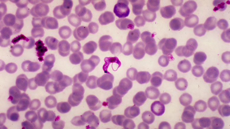This is a micrograph of Trypanosoma cruzi in a blood smear using Giemsa staining technique, 1977. Image courtesy CDC/Dr. Mae Melvin. (Photo by Smith Collection/Gado/Getty Images).