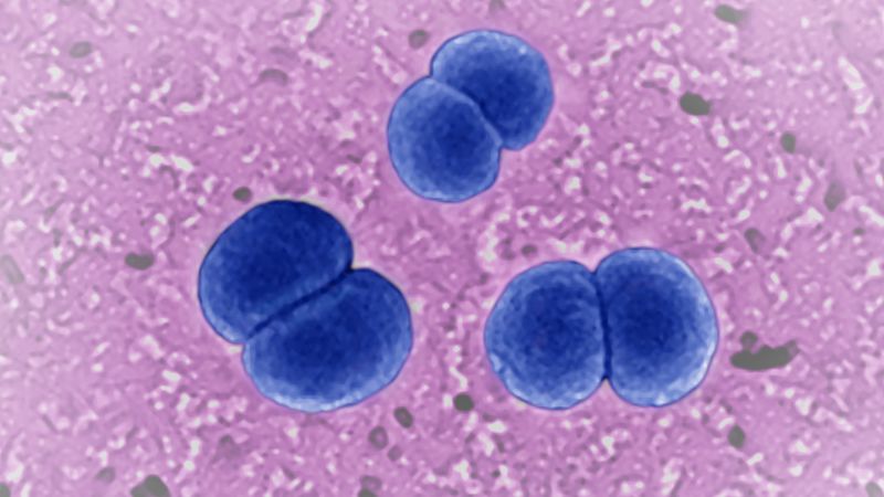 CDC предупреждава лекарите да следят за рядка, сериозна бактериална инфекция, появяваща се с необичайни симптоми
