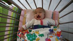 XINING, CHINA - OCTOBER 21: (CHINA OUT) A baby afflicted with a cleft lip and palate lies in a crib at the Xining Orphan and Disabled Children Welfare Center on October 21, 2006 in Xining of Qinghai Province, China. The center, which houses 114 orphans and disabled children, integrates education, medical treatment, rehabilitation and foster home services.  (Photo by China Photos/Getty Images)