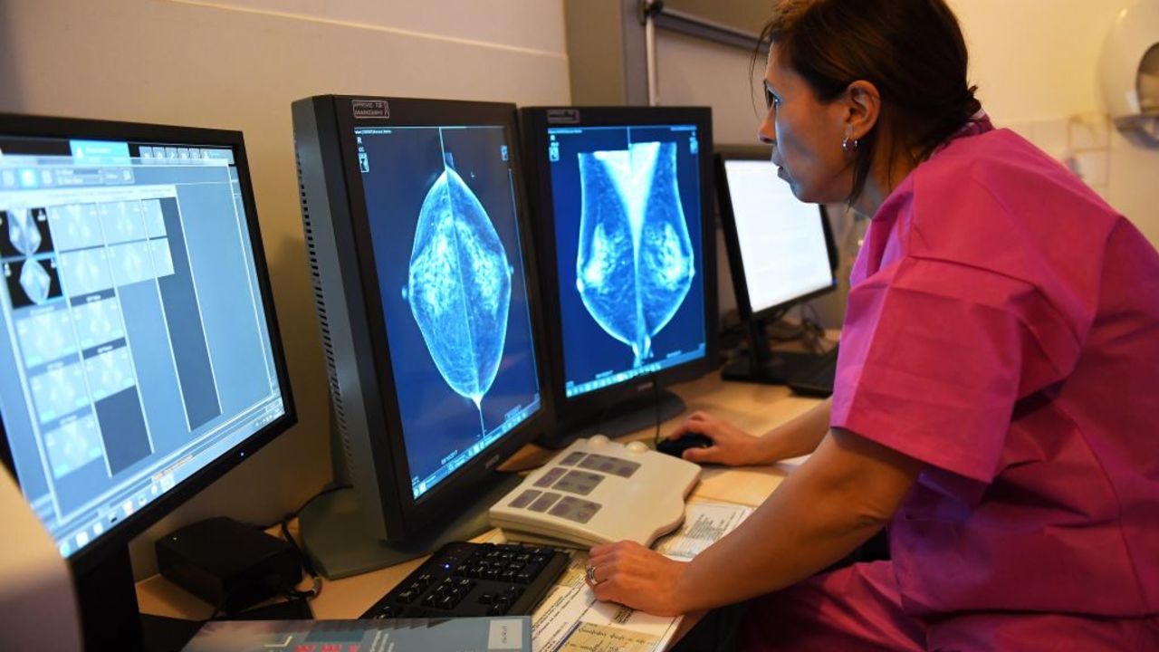 Doctor Rim Villard looks at the results of a mammography, on October 9, 2017 at the Paoli-Calmette institute, a fight against cancer regional centre. (Photo by ANNE-CHRISTINE POUJOULAT / AFP)        (Photo credit should read ANNE-CHRISTINE POUJOULAT/AFP via Getty Images)