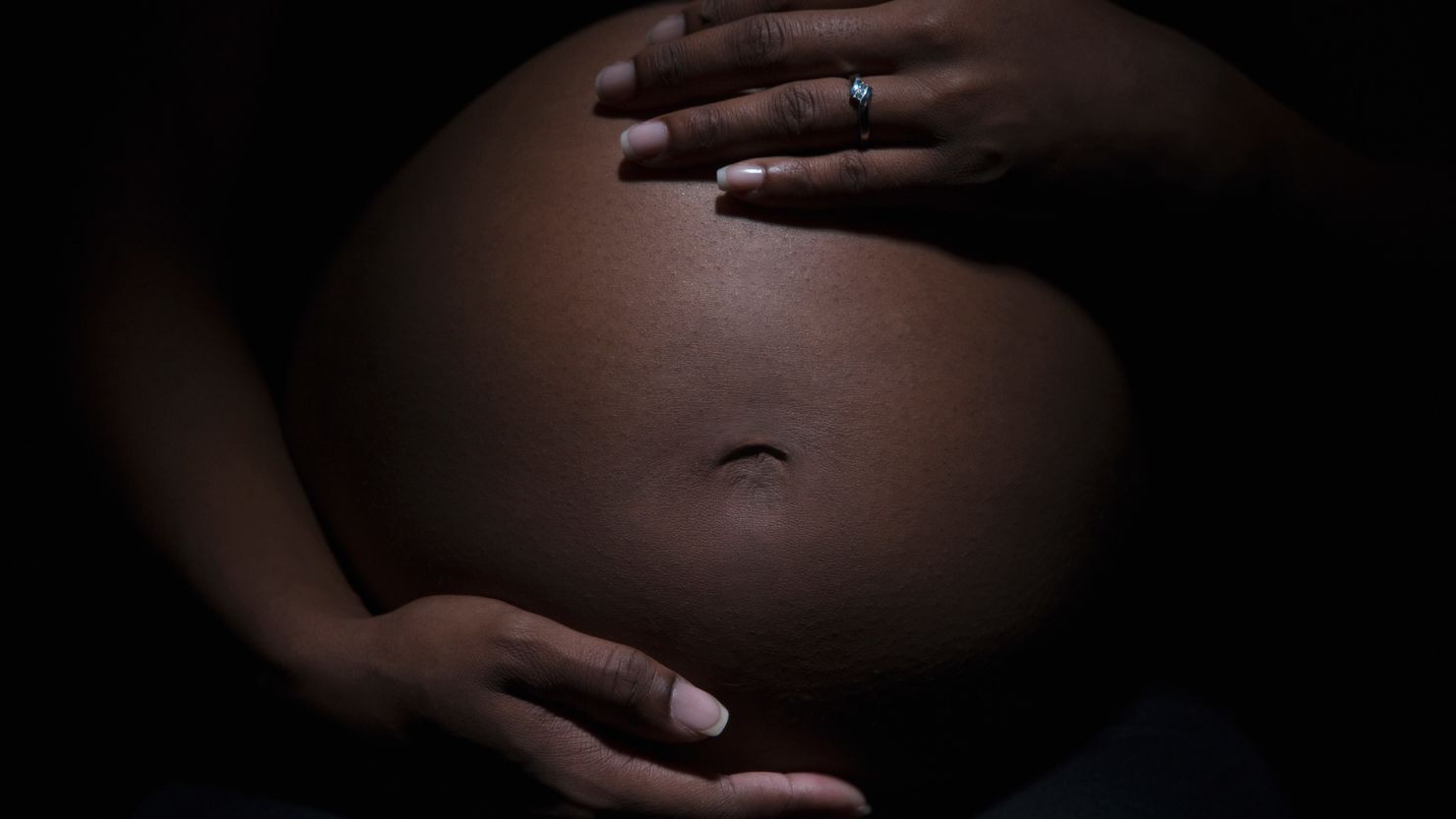 Despite a fall in the US maternal mortality rate in 2022, the rate for Black women was still significantly higher than rates for White, Hispanic and Asian women.