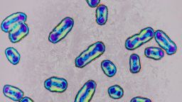 Yersinia pestis, formerly pasteurella pestis, Bacteria responsible for the plague. Seen under optical microscopy X 1000. (Photo by: BSIP/Universal Images Group via Getty Images)