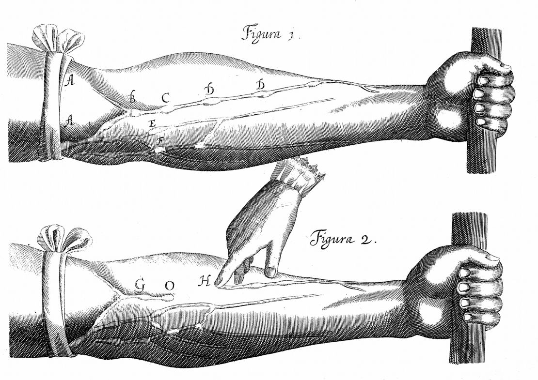 A 17th-century diagram, by English physician William Harvey, illustrating tourniquet and effects on blood circulation.
