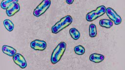 Yersinia pestis, formerly pasteurella pestis, Bacteria responsible for the plague. Seen under optical microscopy X 1000.