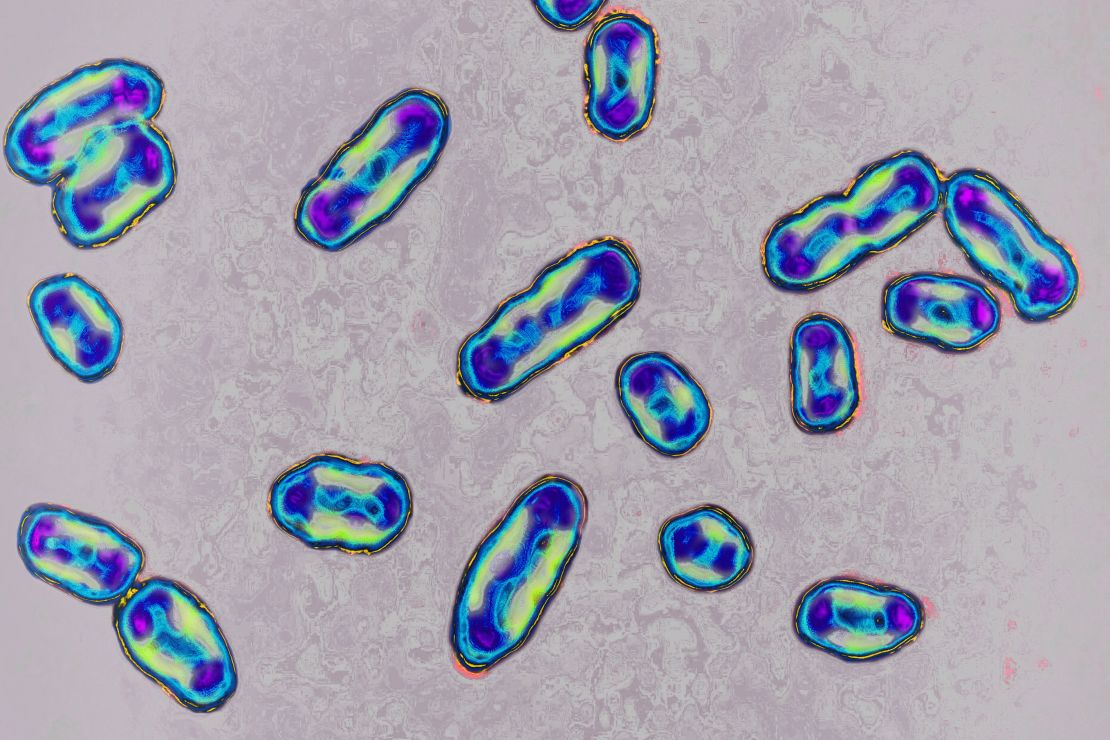 ينظر هنا تحت المجهر ، Yersinia pestis هي البكتيريا المسؤولة عن الطاعون.