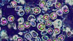 The measles virus, paramyxoviridae from the Morbillivirus family, transmission microscopy view.