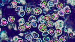 The measles virus, paramyxoviridae from the Morbillivirus family, transmission microscopy view. (Photo by: BSIP/Universal Images Group via Getty Images)