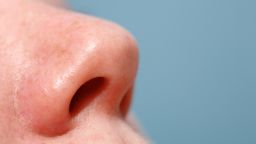 Cận cảnh chiếc mũi của một người phụ nữ hướng lên trên với nền màu xanh