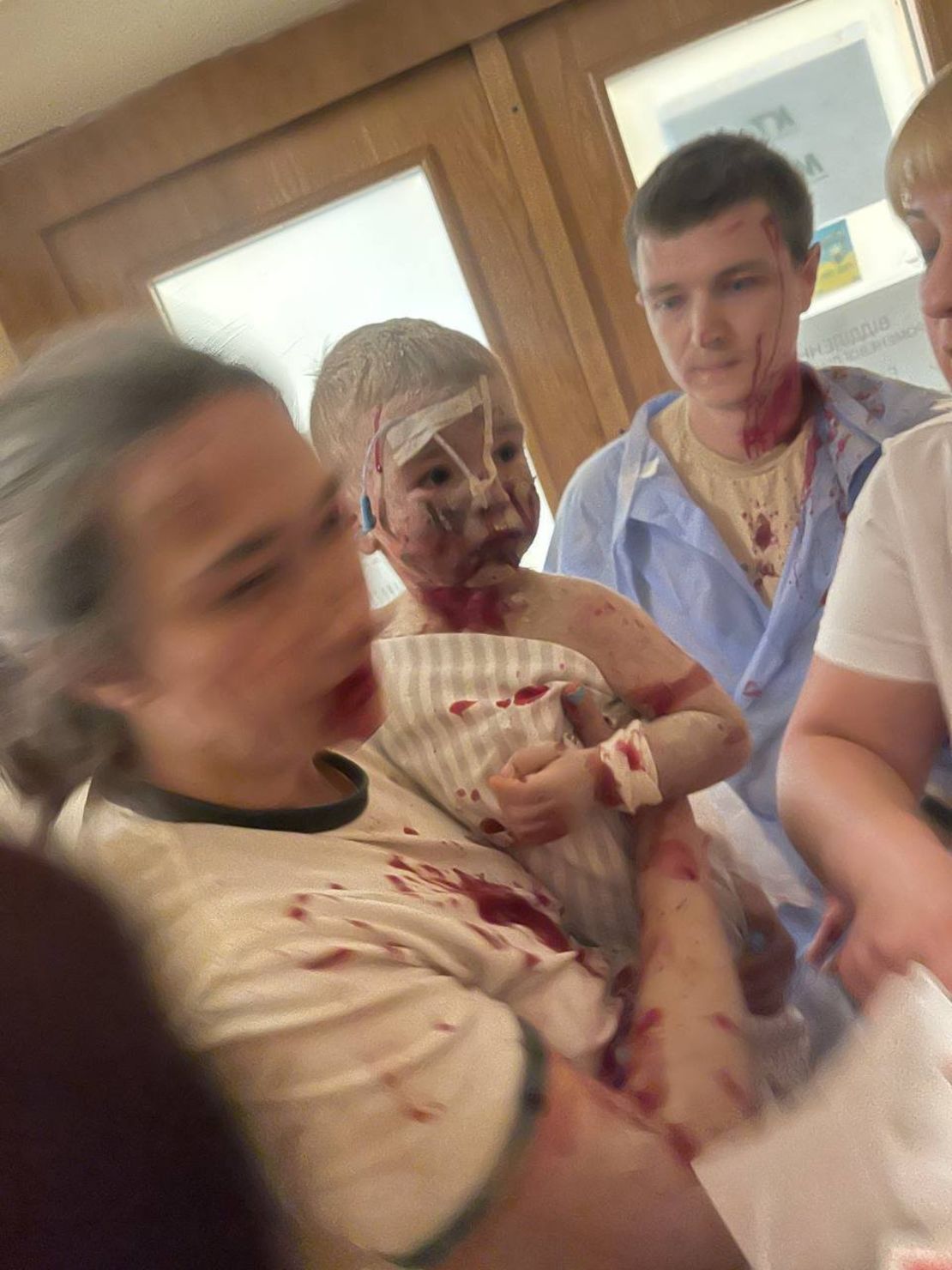 A picture shared by President Zelensky on his official X page showing a young patient injured in the strike.